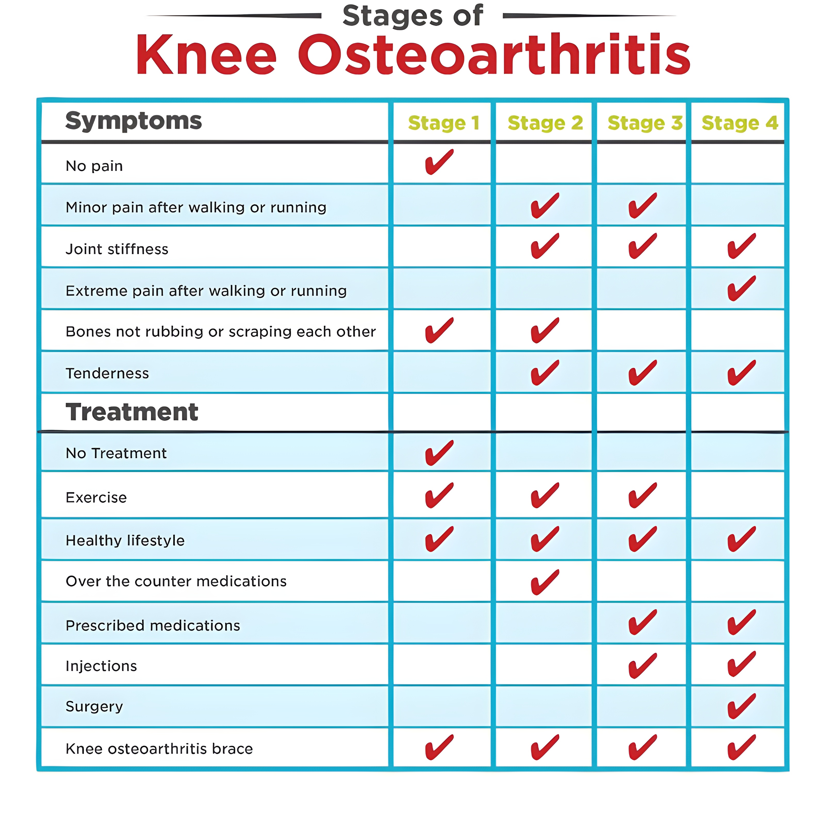 Таблица симптомов остеоартрита на разных стадиях