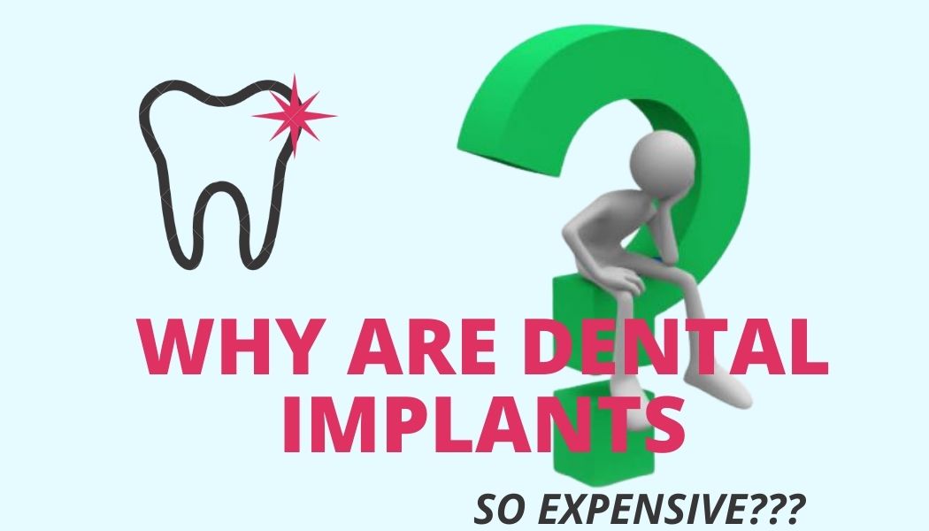 Инфографика - думающий человек, почему имплантаты такие дорогие, рисунок зуба
