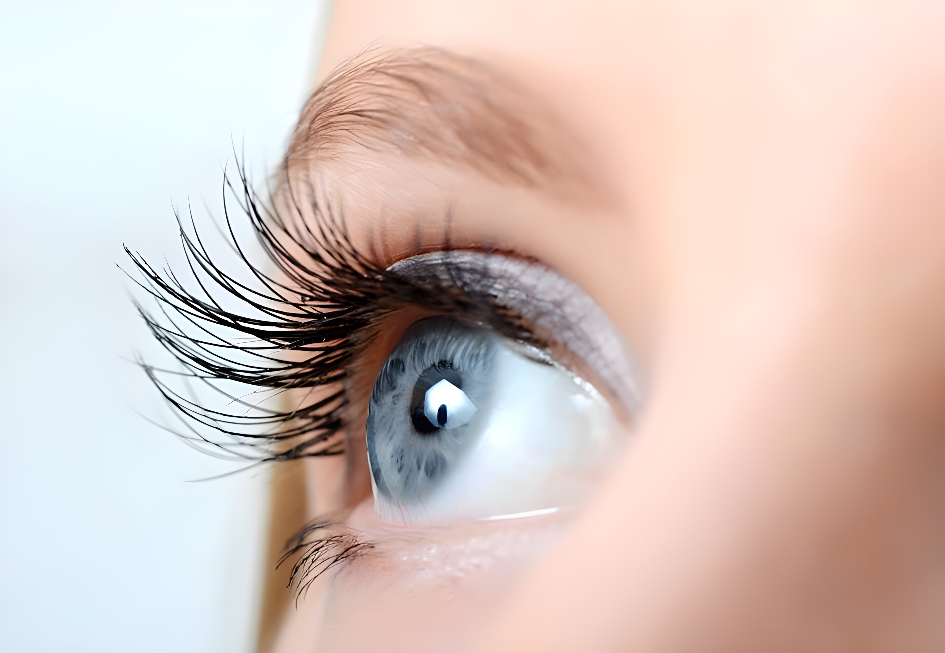 правый женский глаз после операции lasik